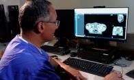 微軟用AI縮短癌癥放療時間 掃描速度提高2.5倍