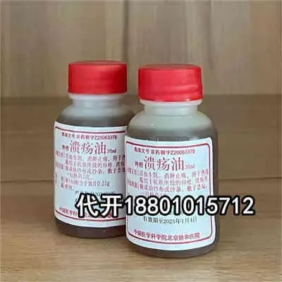 北京知名医院溃疡油抹多长时间，适用火疖子的终端用户吗？18801015712